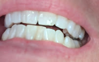 Navarro Dental