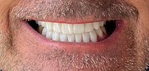 Castle Dental