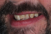 Castle Dental