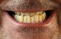 Castle Dental