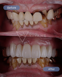 Dentist Los Algodones:Vivant Smile Design