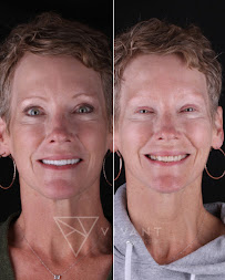Dentist Los Algodones:Vivant Smile Design