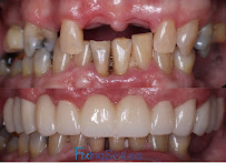 Fixing Smiles Los Algodones