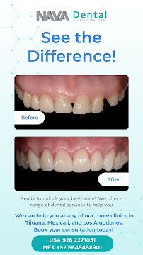 Nava Dental