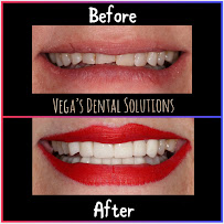Vega’s Dental Solutions & Vegaendodontics