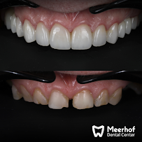 Meerhof Dental Center