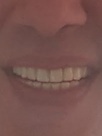 Smile Dental Services
