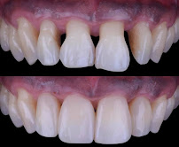 Dental clinic MGD dental clinic Dr. M. Dyukendzhieva