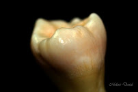 Dental clinic MGD dental clinic Dr. M. Dyukendzhieva