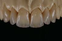 Dental clinic MGD dental clinic Dr. M. Dyukendzhieva