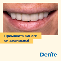 Dente