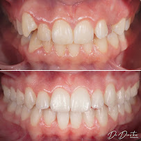 Д-р Димитър Димитров - Ортодонтия/ Dr. Dimitar Dimitrov - Stankov Dental