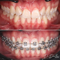 Д-р Димитър Димитров - Ортодонтия/ Dr. Dimitar Dimitrov - Stankov Dental