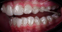 Д-р Димитър Димитров - Ортодонтия/ Dr. Dimitar Dimitrov - Stankov Dental