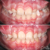 Д-р Димитър Димитров - Ортодонтия/ Dr. Dimitar Dimitrov - Stankov Dental