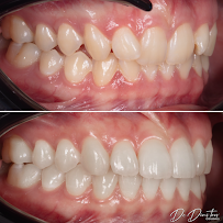 Д-р Димитър Димитров - Ортодонтия/ Dr. Dimitar Dimitrov - Stankov Dental