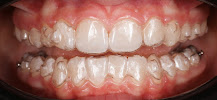 Д-р Димитър Димитров - Ортодонтия/ Dr. Dimitar Dimitrov - Stankov Dental