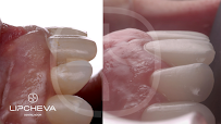Д-р Ваня Липчева - Пародонтология | Имплантология | Естетика | Dr. Vanya Lipcheva - Periodontology | Implantology | Esthetics