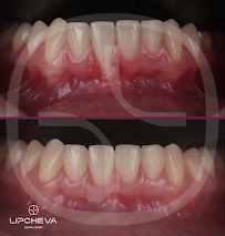 Д-р Ваня Липчева - Пародонтология | Имплантология | Естетика | Dr. Vanya Lipcheva - Periodontology | Implantology | Esthetics