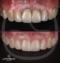 Д-р Ваня Липчева - Пародонтология | Имплантология | Естетика | Dr. Vanya Lipcheva - Periodontology | Implantology | Esthetics