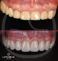Д-р Ваня Липчева - Пародонтология | Имплантология | Естетика | Dr. Vanya Lipcheva - Periodontology | Implantology | Esthetics