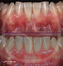 Д-р Ваня Липчева - Пародонтология | Имплантология | Естетика | Dr. Vanya Lipcheva - Periodontology | Implantology | Esthetics