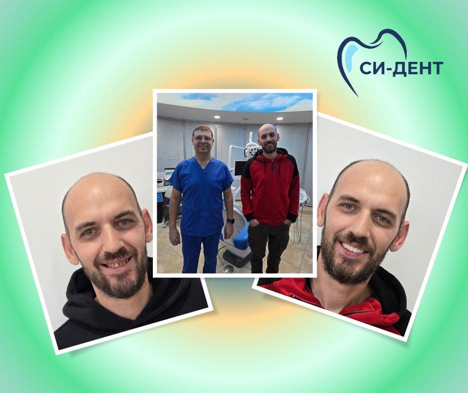 Before and after treatment at SI-Dent Dental Center