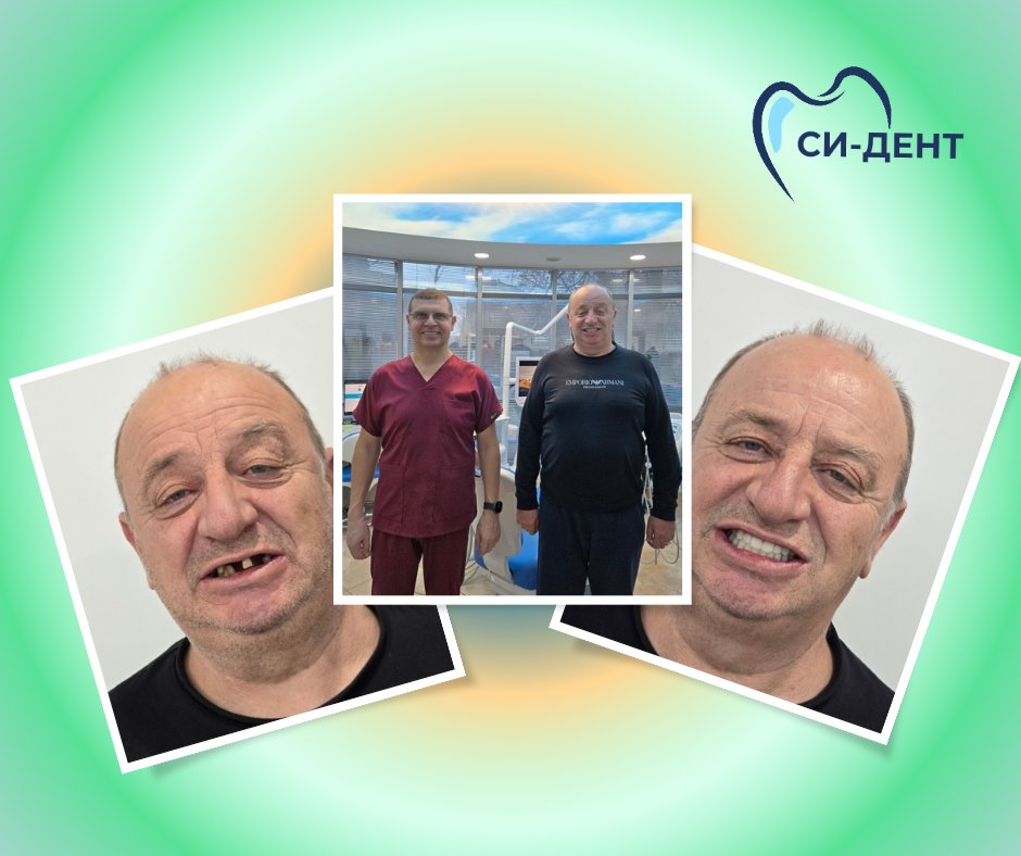 Before and after treatment at SI-Dent Dental Center