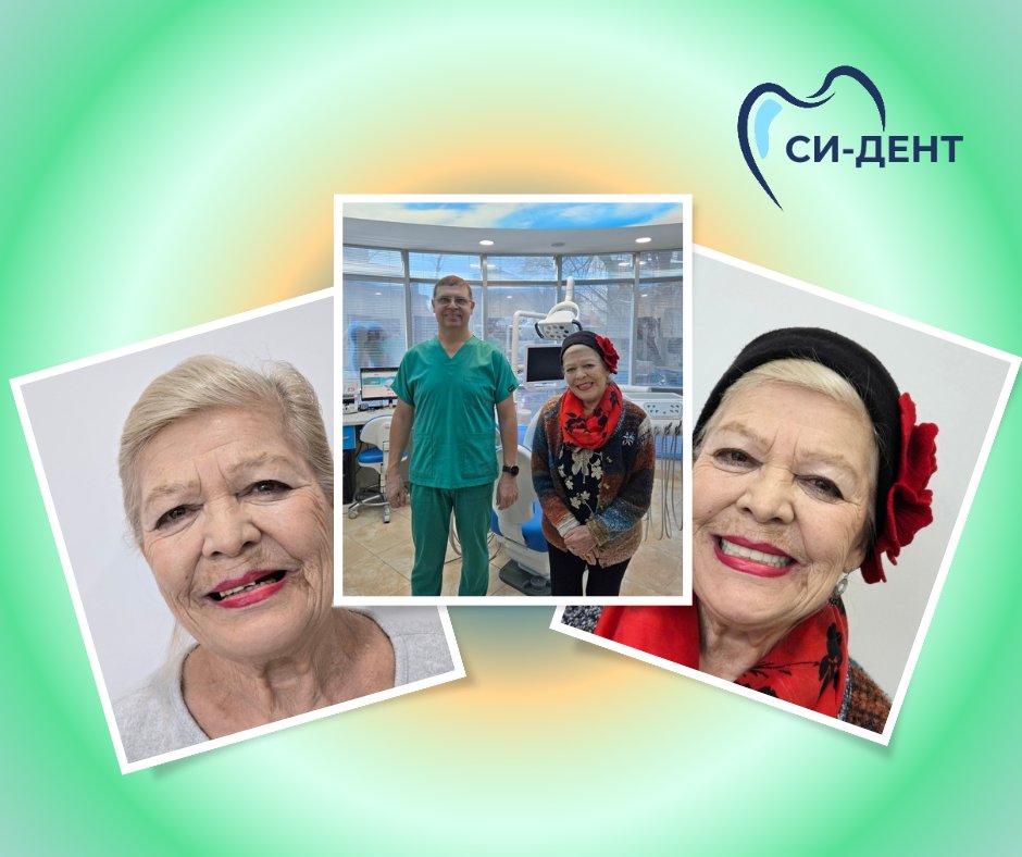 Before and after treatment at SI-Dent Dental Center