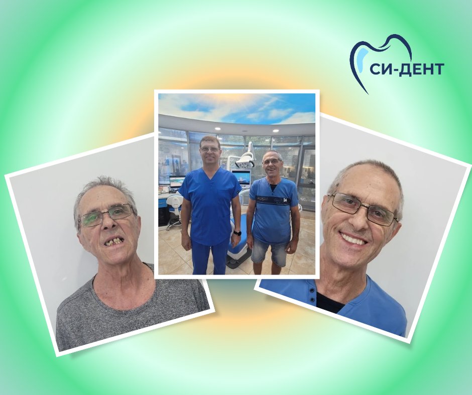 Before and after treatment at SI-Dent Dental Center