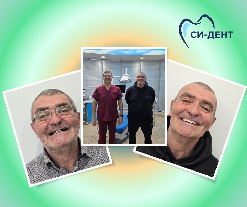 Before and after treatment at SI-Dent Dental Center