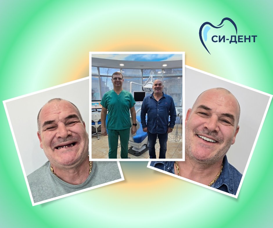 Before and after treatment at SI-Dent Dental Center
