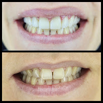 Smilehub Varna Dental Studio| Зъболекар Варна| д-р Йоанна Недялкова
