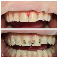 Smilehub Varna Dental Studio| Зъболекар Варна| д-р Йоанна Недялкова