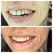 Smilehub Varna Dental Studio| Зъболекар Варна| д-р Йоанна Недялкова