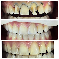 Smilehub Varna Dental Studio| Зъболекар Варна| д-р Йоанна Недялкова