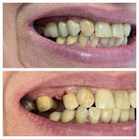 Smilehub Varna Dental Studio| Зъболекар Варна| д-р Йоанна Недялкова