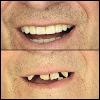 Smilehub Varna Dental Studio| Зъболекар Варна| д-р Йоанна Недялкова