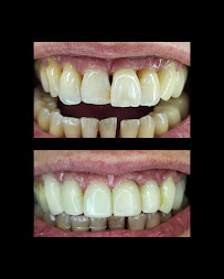 Smilehub Varna Dental Studio| Зъболекар Варна| д-р Йоанна Недялкова