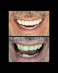 Smilehub Varna Dental Studio| Зъболекар Варна| д-р Йоанна Недялкова