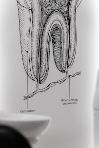 Dentall