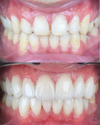 Elite Smile in Barranquilla