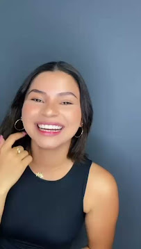 Elite Smile | Diseño de Sonrisa | Porcelain Veneers Barranquilla