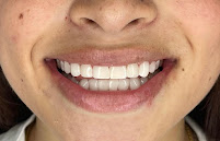 Elite Smile | Diseño de Sonrisa | Porcelain Veneers Barranquilla