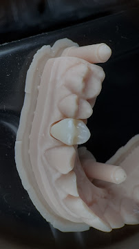 Elite Smile | Diseño de Sonrisa | Porcelain Veneers Barranquilla