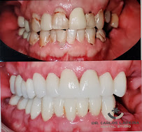 Dr Carlos Lapeira Dental Studio