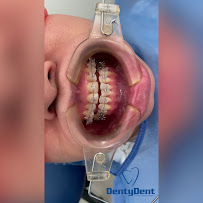 Dentydent SAS