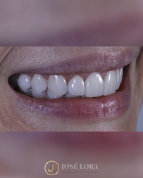 Dr. Jose Lora - Odontología Especializada