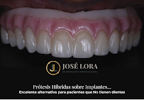 Dr. Jose Lora - Odontología Especializada