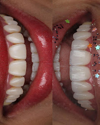 Dr. Adrian Donado - Alta Estética Dental y Armonización Orofacial